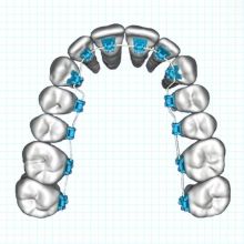 SureSmile