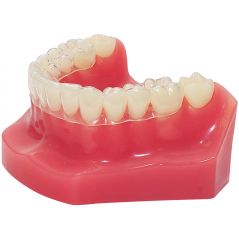 Retainers